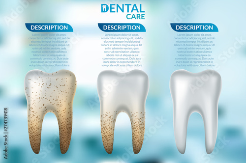 Teeth whitening 3d concept. Comparison of clean and dirty tooth before and after whitening treatment.