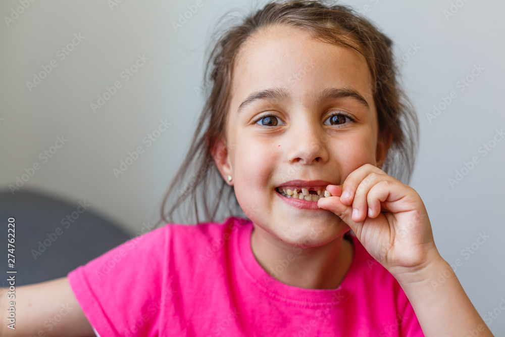 closeup portrait of funny smiling little girl without one front tooth closeup portrait of funny smiling little girl without one front tooth