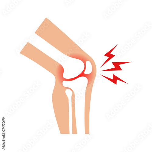 Knee joint pain illustration. Vector.