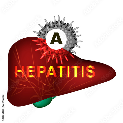 Hepatitis A. World Hepatitis Day. Infographics. Vector illustration on isolated background.
