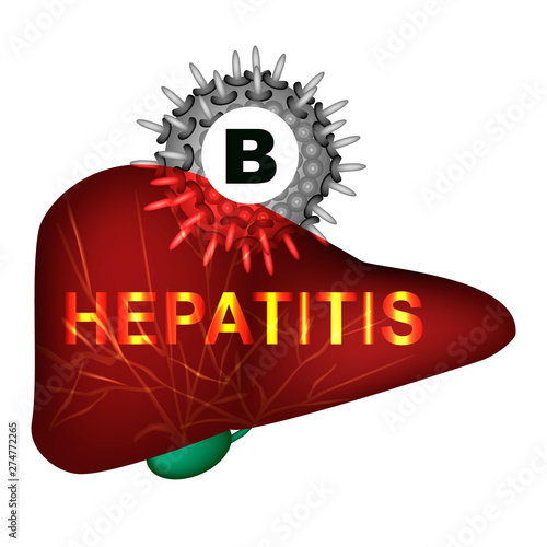 Hepatitis B. World Hepatitis Day. Infographics. Vector illustration on isolated background.