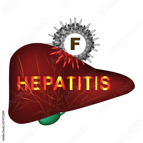 Hepatitis F. World Hepatitis Day. Infographics. Vector illustration on isolated background.