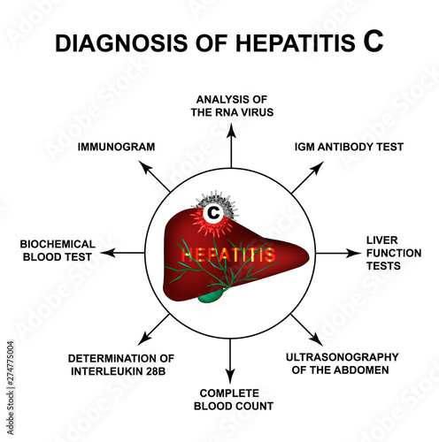 Diagnosis of hepatitis C. World Hepatitis Day. Infographics. Vector illustration on isolated background.