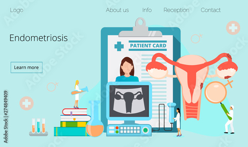 Tiny doctors examine uterus with magnifier to treat endometriosis. Endometriosis, endometrium dysfunctionality, endometriosis treatment concept. Modern vector for website and mobile website.