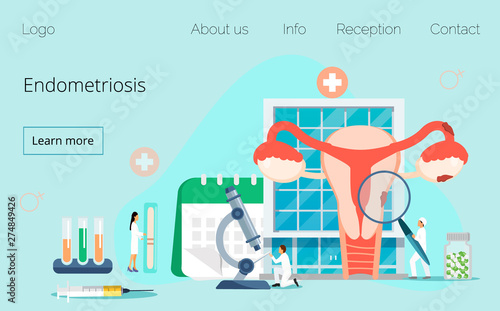 Tiny doctors examine uterus with magnifier to treat endometriosis. Endometriosis, endometrium dysfunctionality, endometriosis treatment concept. Modern vector for website and mobile website. photo