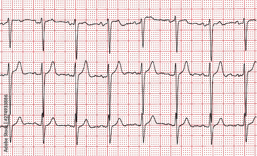 Cardiogram. Fragment of research result by CU