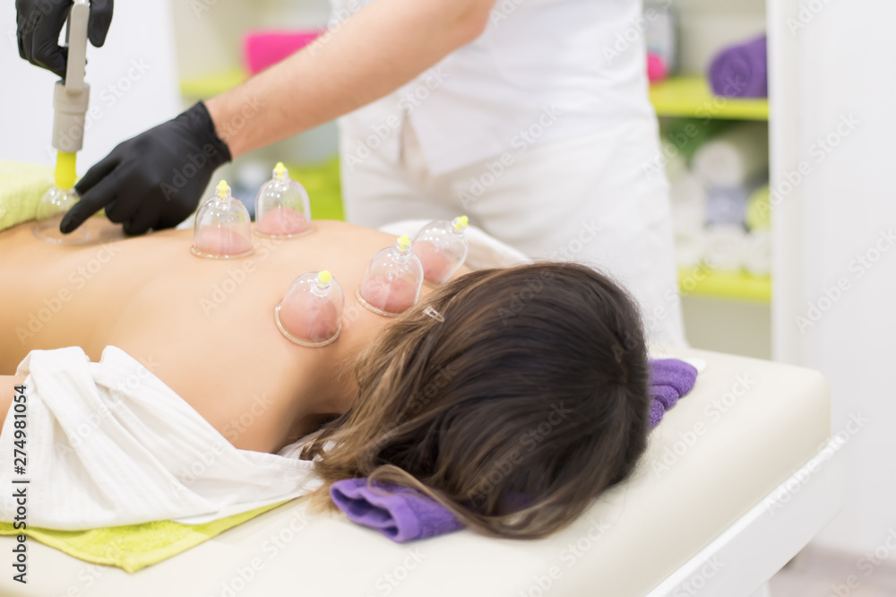 Young woman laying down at the massage table and doing hijama treatment Young woman laying down at the massage table and doing hijama treatment