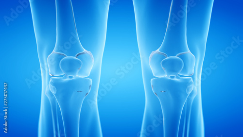 3d rendered illustration of the human, skeletal knee © Sebastian Kaulitzki