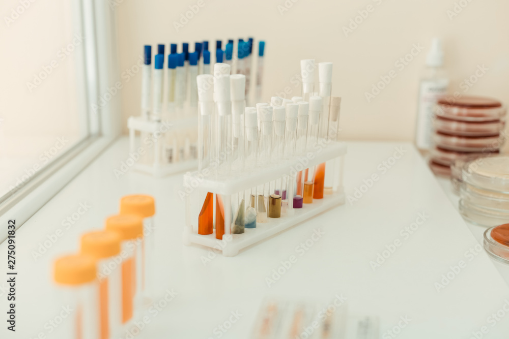 Close up of test tubes with colorful liquids Close up of test tubes with colorful liquids