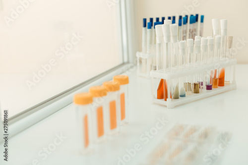 Close up of a test tube rack on the table
