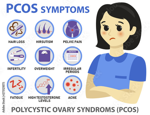 Symptoms of PCOS infographics. Detailed vector infographics.