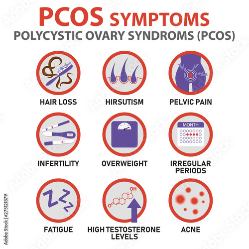 Symptoms of PCOS infographics. Detailed vector infographics.