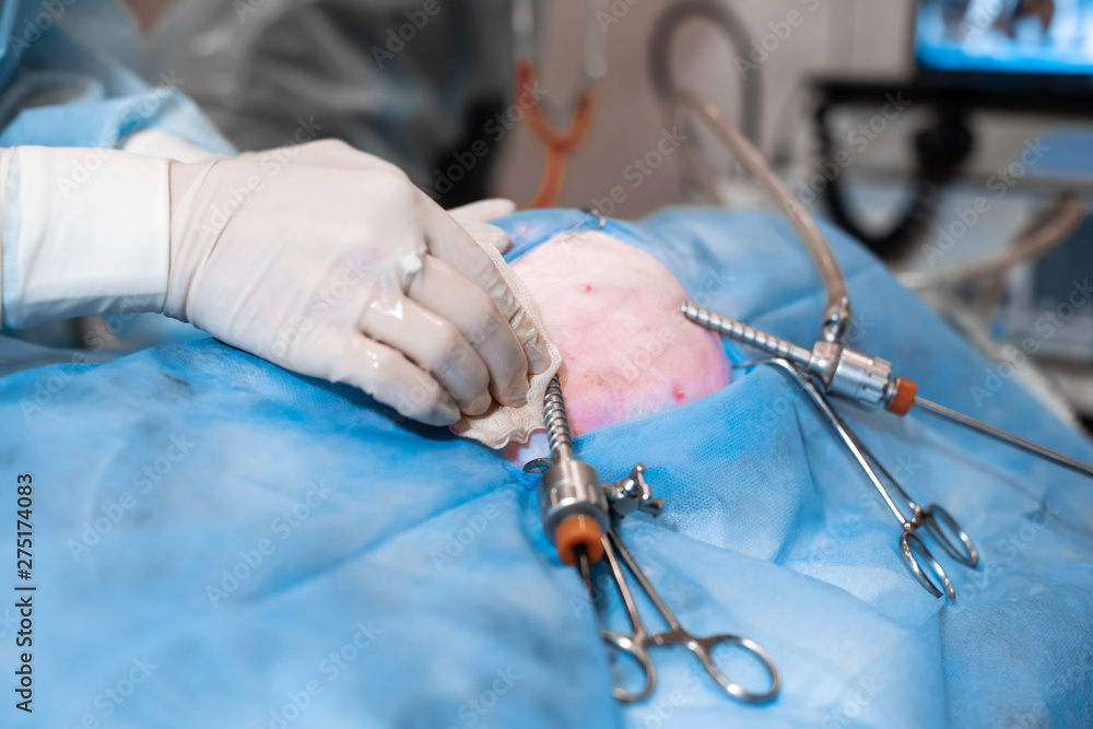 Vet doing the operation for sterilization. The cat on the operating table in a veterinary clinic. Cat in a veterinary surgery , the uterus and ovaries of a cat during surgery Vet doing the operation for sterilization. The cat on the operating table in a veterinary clinic. Cat in a veterinary surgery , the uterus and ovaries of a cat during surgery