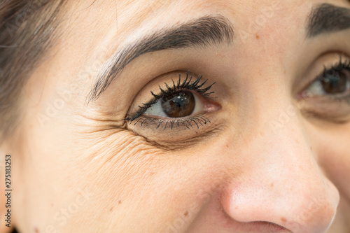 A close-up view of a young woman with brown eyes and crow’s feet. Wrinkles at the side of the eye caused by laughter and aging of the skin