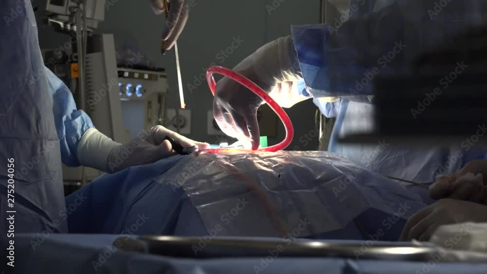 Spinal disc herniation is an injury to the cushioning and connective