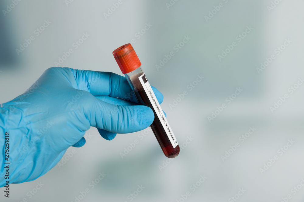 Doctor's hand with medical glove holding a blood probe in front of a lab - obrazy, fototapety, plakaty 