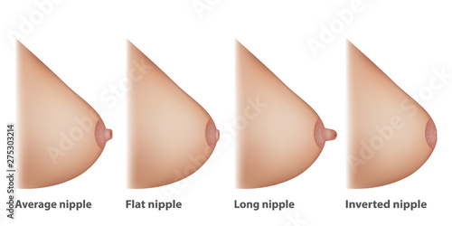 Types of Nipples (Average, Inverted, Long and Flat nipple)
