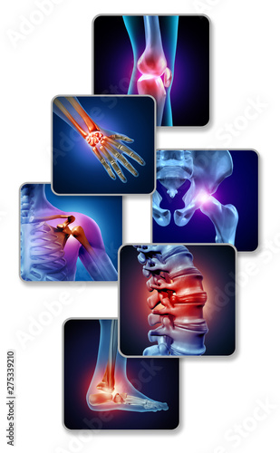 Obraz na plátně Human Joint Pain