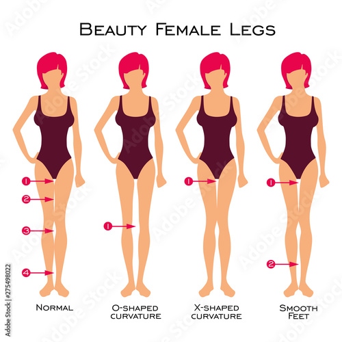 Сanon of beauty of female legs is 4 gaps in the silhouette of the legs. Set of silhouette of a female figure. Types of curvature of the legs. Vector image