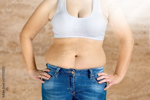 Woman with fat belly on  background. © BillionPhotos.com