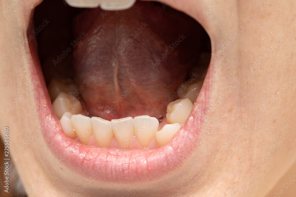 what does a healthy tongue look like