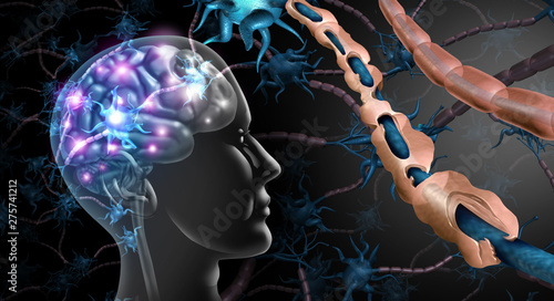 Multiple Sclerosis Nerve Disorder