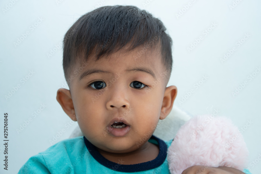 Baby has an allergic reaction to the eye, Urticaria in food allergy patien Baby has an allergic reaction to the eye, Urticaria in food allergy patien