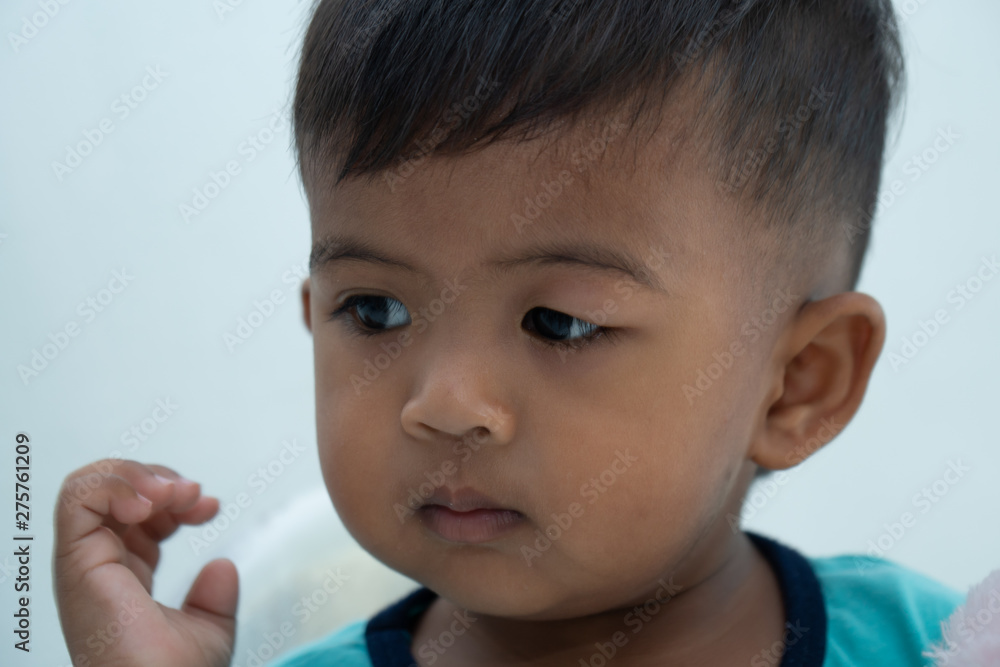Baby has an allergic reaction to the eye, Urticaria in food allergy patien Baby has an allergic reaction to the eye, Urticaria in food allergy patien