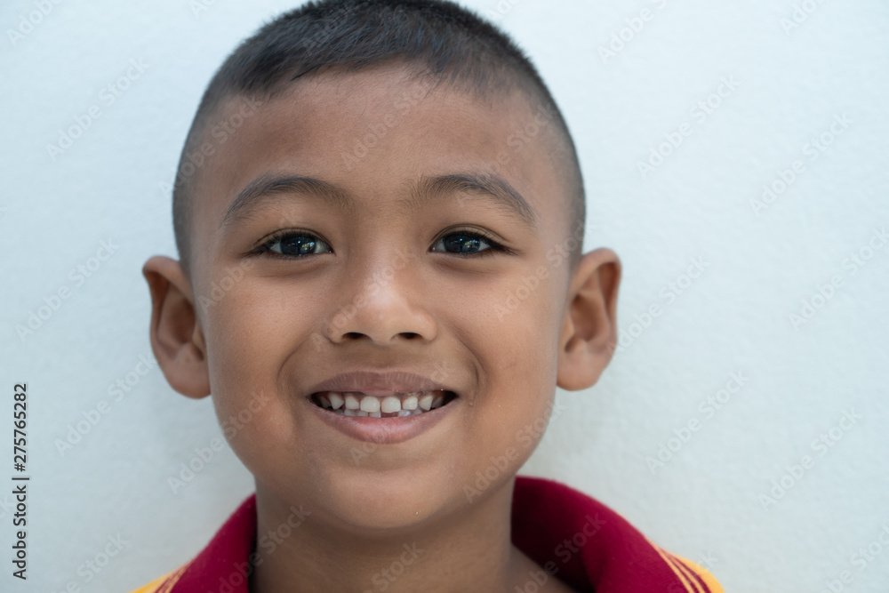 Little boy smiling with Broken teeth Little boy smiling with Broken teeth