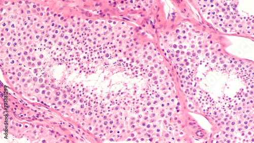 Cross section of a human testis showing seminiferous tubules with spermatogenesis, with germ cell development including spermatagonia, spermatocytes, spermatids and spermatozoa (sperm).  H&E stain. photo