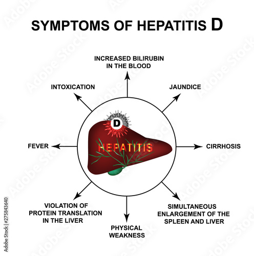 Symptoms of Hepatitis D. World Hepatitis Day. Infographics. Vector illustration on isolated background.