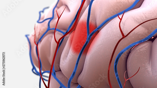 Photos 3D Stroke Brain Illustration with Veins