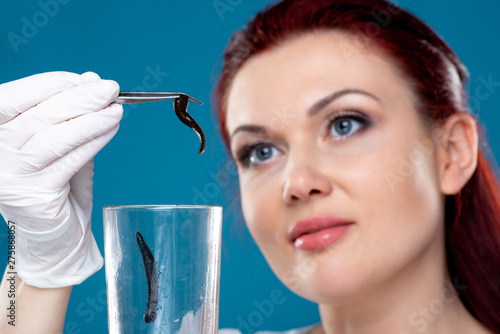 Woman doctor holds tweezers of medical leeches. Hirudotherapy, Hirudo medicinalis. Alternative medicine, bloodletting and rejuvenation of the body photo