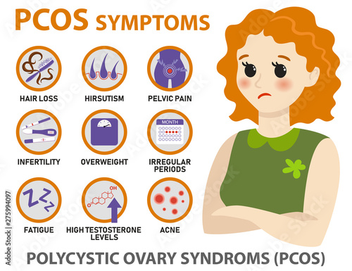 Symptoms of PCOS infographics. Detailed vector infographics.