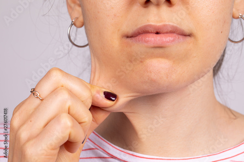 A closeup view of a young Caucasian woman pinching the loose skin around her neck. Body conscious woman considering a platysmaplasty (neck lift). photo