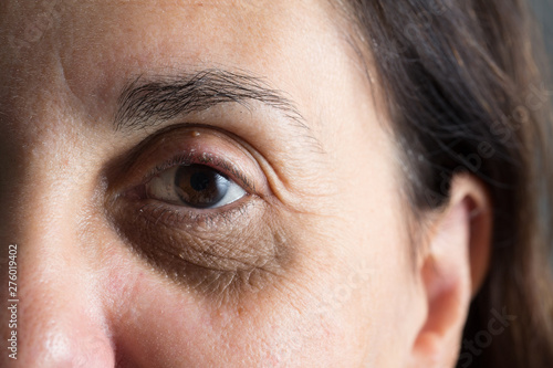 Schilderij op canvas An extreme closeup view of an aging woman with wrinkles and crow’s feet