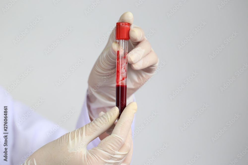 Doctor hand holding blood collection tubes in hematology laboratory, Medicine and science concept Doctor hand holding blood collection tubes in hematology laboratory, Medicine and science concept