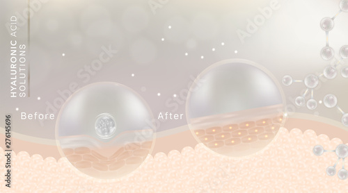 Hyaluronic acid before and after skin solutions ad, white collagen serum drop with cosmetic advertising background ready to use, illustration vector. photo