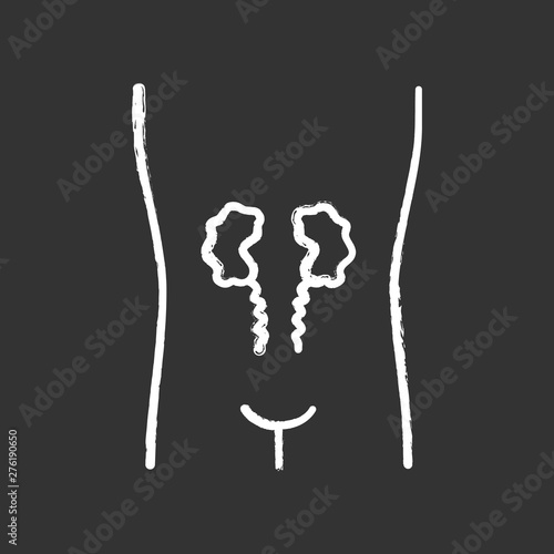 Ill kidneys chalk icon. Sore human organ. Unhealthy urinary system. Nephropathy. Sick internal body part. Kidney failure. Isolated vector chalkboard illustration