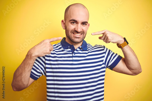 Young bald man with beard wearing casual striped blue t-shirt over yellow isolated background smiling cheerful showing and pointing with fingers teeth and mouth. Dental health concept.