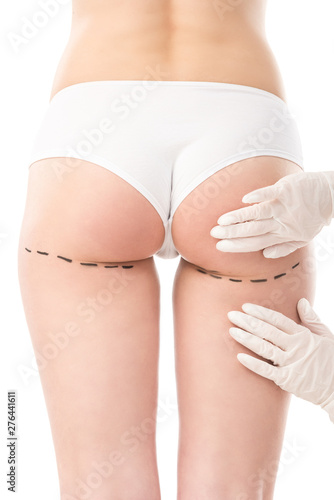 cropped view of plastic surgeon in latex gloves and patient in panties with marks on body isolated on white