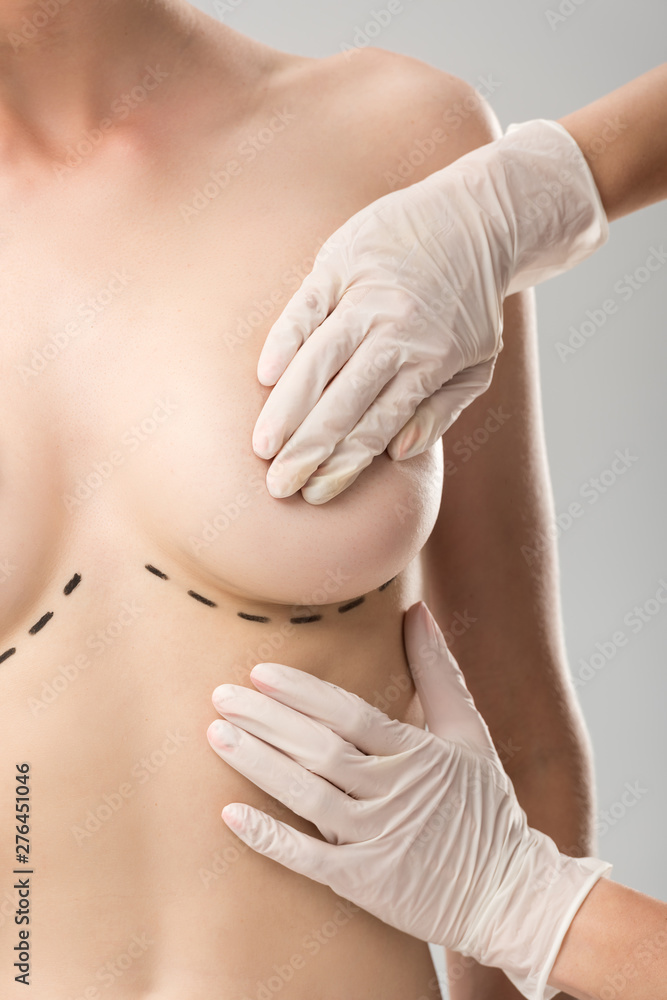 partial view of plastic surgeon in latex gloves and patient with marks under breast isolated on grey