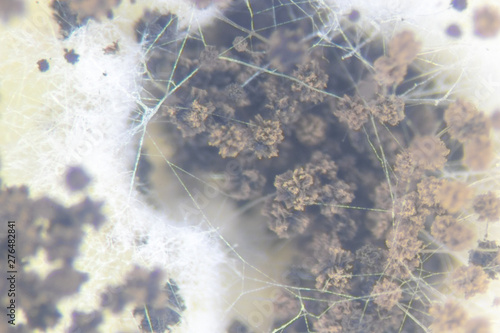 Aspergillus  mold  for Microbiology in Lab.