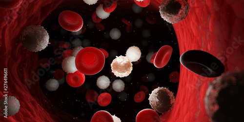 3d rendered medically accurate illustration of too many white blood cells due to leukemia photo