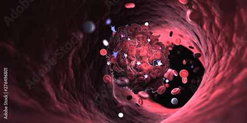 Konstfotografi 3d rendered medically accurate illustration of a blood clot