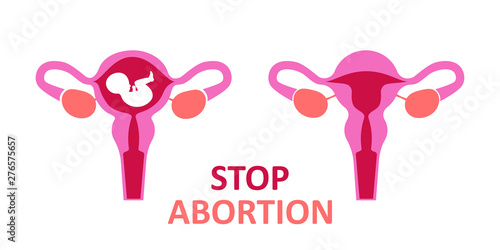 Two wombs. One with a child, the other without a child. Stop abortion sign. Flat vector on white background
