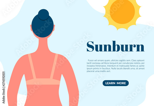 Sunburned woman back view cartoon character. Sun tanning danger concept. Skin redness flat vector illustration