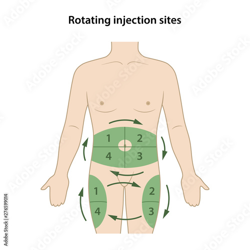 Diabetes. The circle of injection sites is shown on the male body by numbering the corresponding steps. Anatomical vector illustration in flat style isolated on white background.