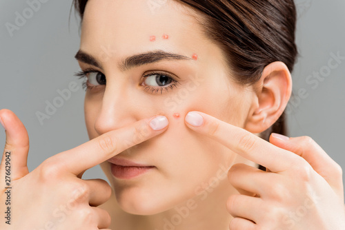 Quadro su tela young woman with acne touching face and looking at camera isolated on grey