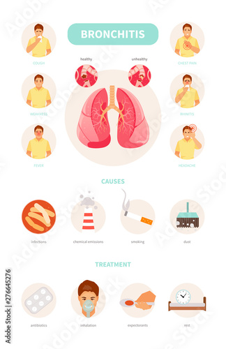 Bronchitis symptoms, causes and treatment